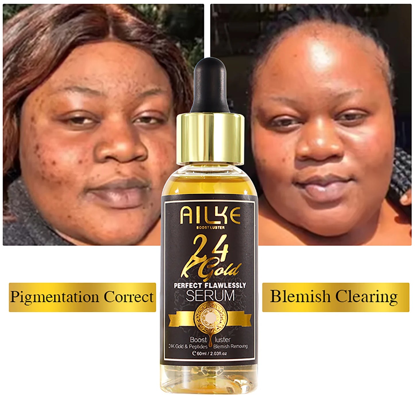 AILKE 24k Gold Whitening Range For All Skin Types, Remove Dark Spots, Wrinkles, Hyperpigmentation, Moisturizing, Hydration