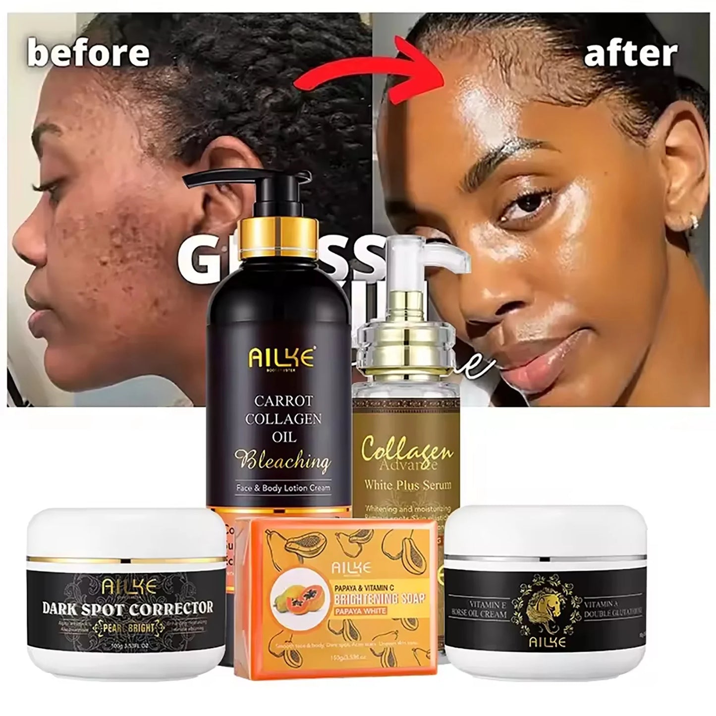 AILKE Collagen Skin Care Kit, Reduce Spots, Whitening, Even Skin Tone, For Dark Skin, Black Skin, African Skin, Caramel Skin