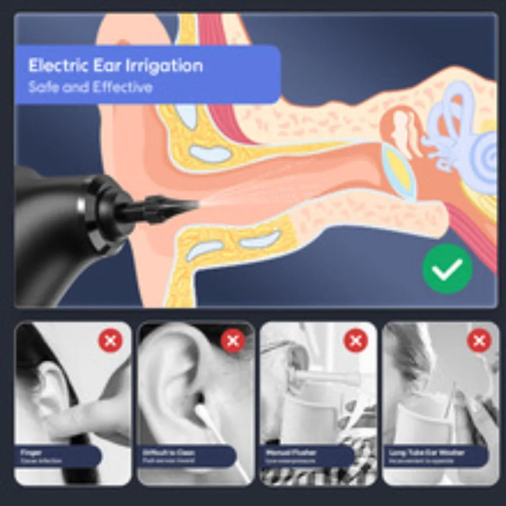 Electric Ear Cleaner Kit 4 Pressure Modes Ear Wax Removal Health Care Water Irrigation Ear Washer For Adults Child Ear Cleaner