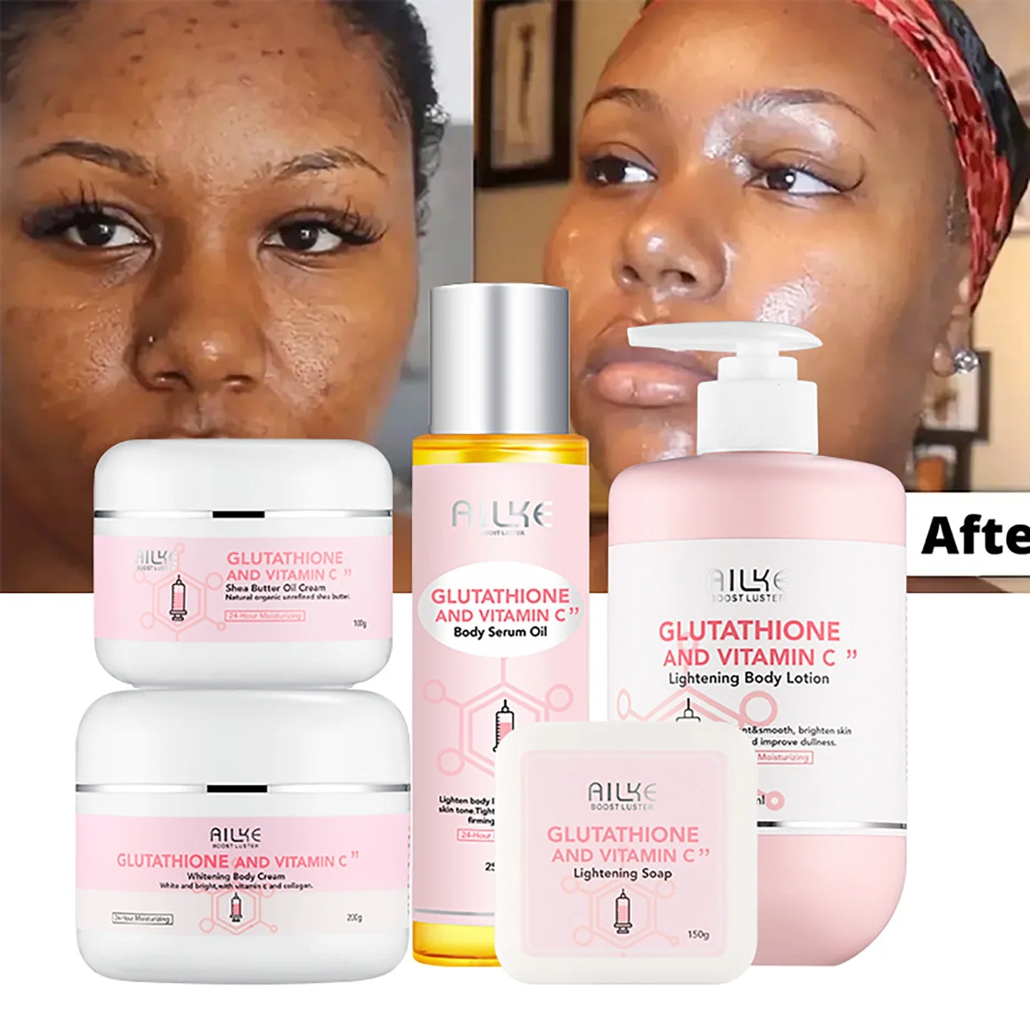 AILKE Whitening Moisturizing Korean Facial And Body Lotion, Reduce Melanin Wrinkles, Vitamin C Dark Spots Remove Skin Care Cream